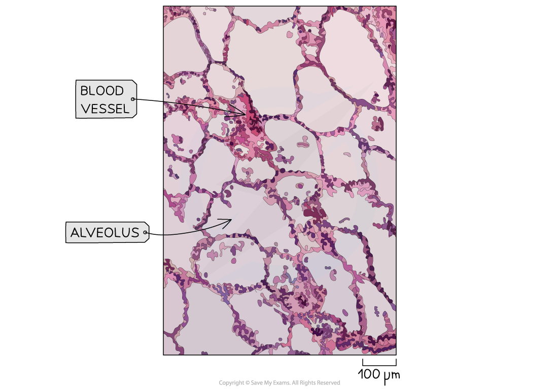 Alveoli-Photomicrograph