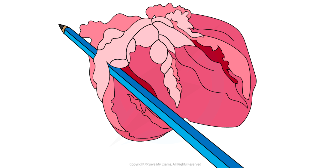 Dissected-heart