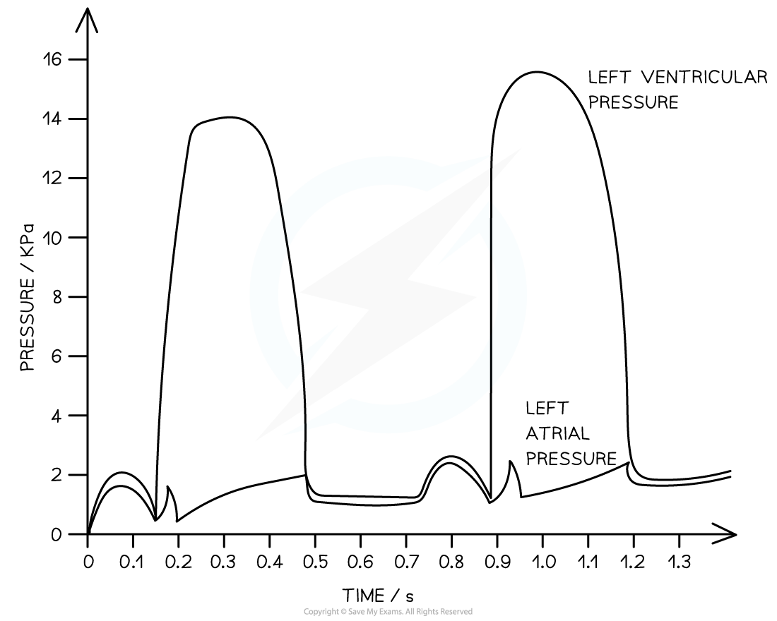 Pressure-in-Left-Atrium-Ventricle