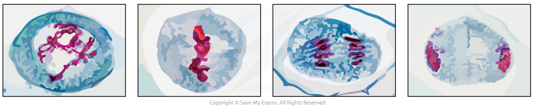 Photomicrograph-showing-stages-of-Meiosis-I