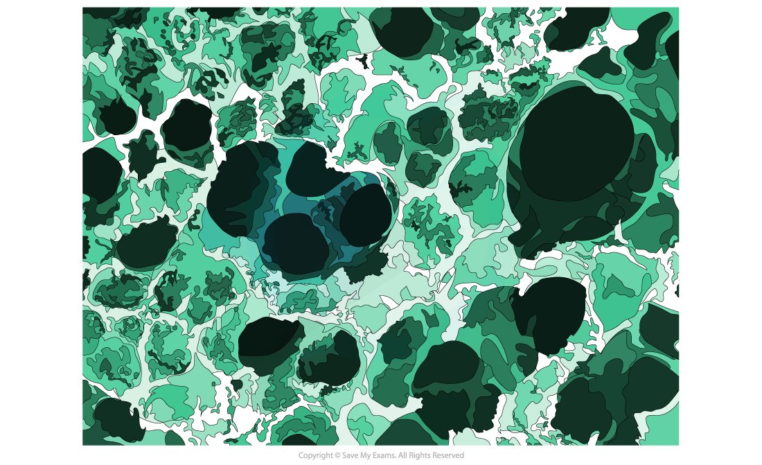 Emphysema-Alveoli