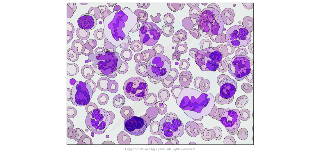 Lymphocyte-Micrograph