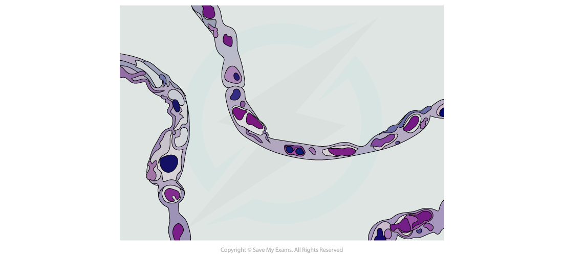 Squamous-Epithelium-Electron-Micrograph