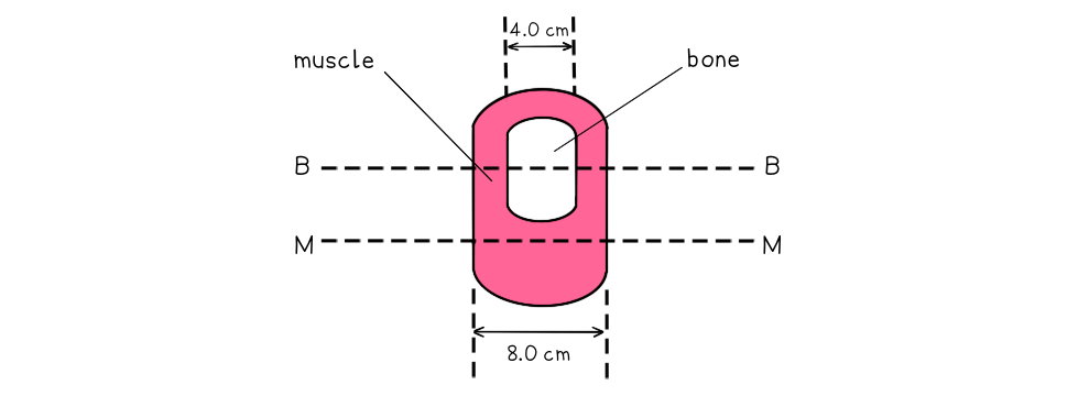 WE-Attenuation-of-X-rays-in-Matter-question-image-1