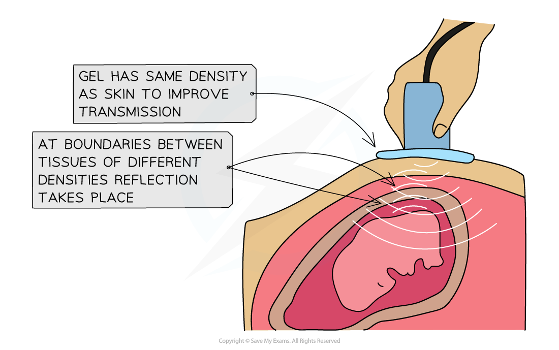 5-30-transmitted-and-reflected-ultrasound_edexcel-al-physics-rn