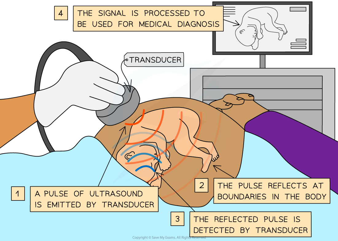 6.1.13-Ultrasound-Medical-Imaging