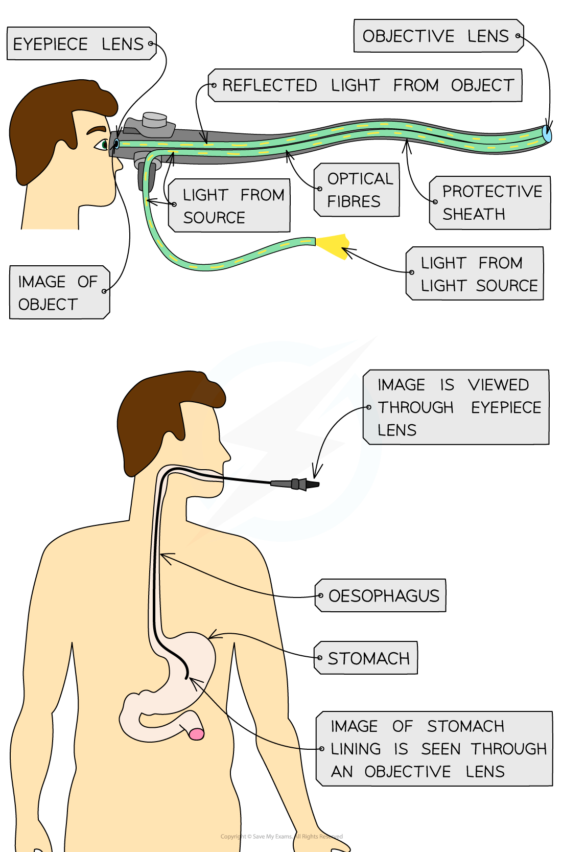 Endoscope