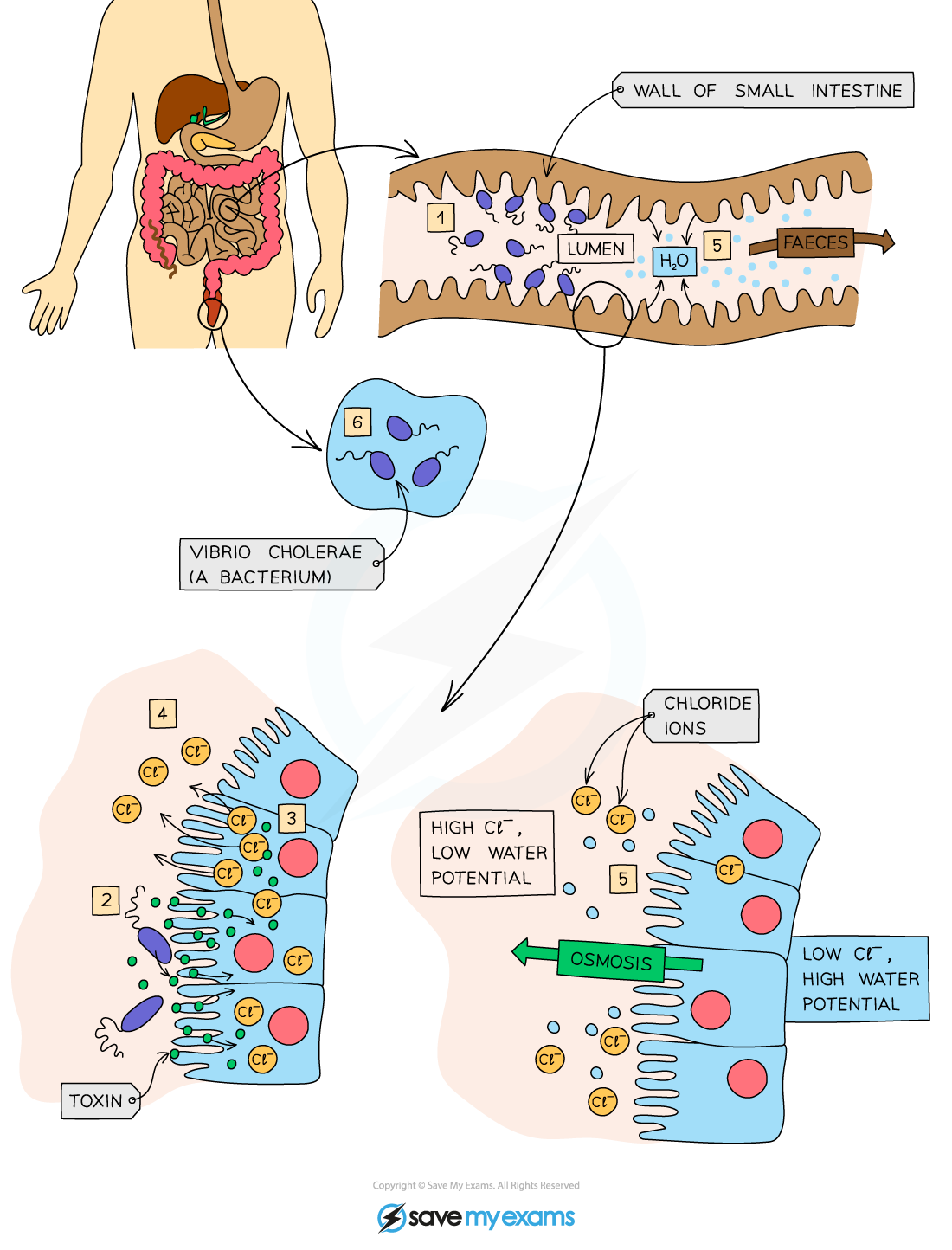 How-cholera-leads-to-diarrhoea